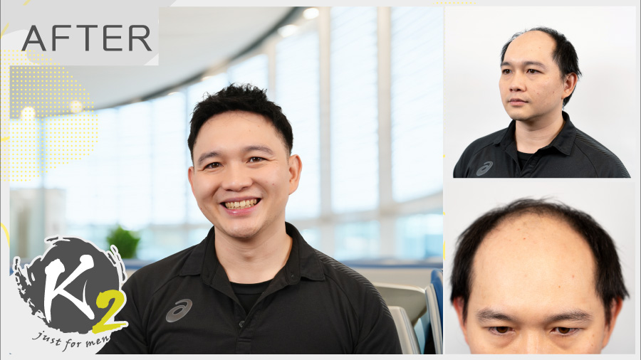 回國，也順便找回頭髮