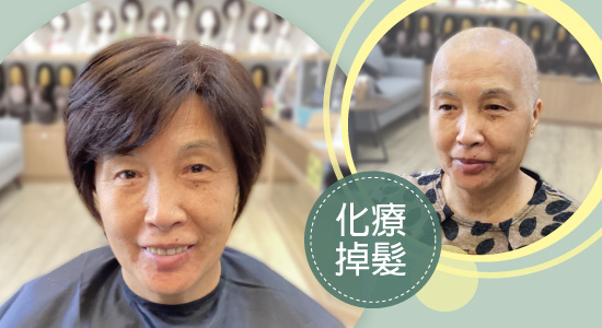 一頂醫療假髮,重拾走出家門的勇氣