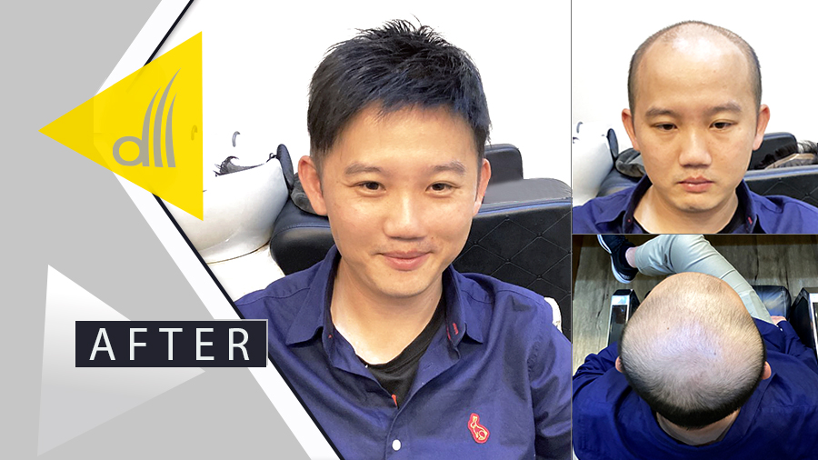 第一次使用髮片，效果比想像中更震撼！